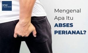 Muncul Lubang Kecil di Dekat Anus