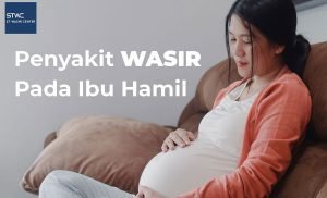 Hemoroid dan Ibu Hamil, Mengapa Sering Terjadi?