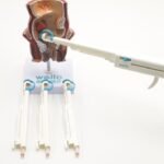 Ambeien Dalam Diikat