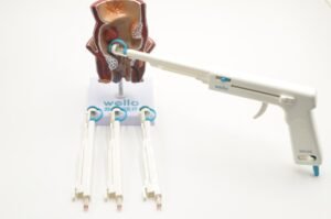 metode ligating band di klinik wasir terdekat