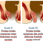 STWC Ambeien Stadium 1-4