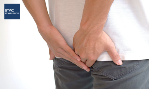 Kini Fistula Ani Sembuh Dengan Radiofrequency