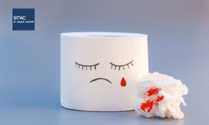 Ambeien Saat Sedang Menstruasi