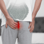 Bagaimana Supaya Wasir Sembuh?