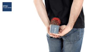 Ciri Wasir yang Perlu Tindakan Medis