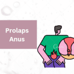 Perbedaan Prolaps Ambeien dan Benjolan Biasa