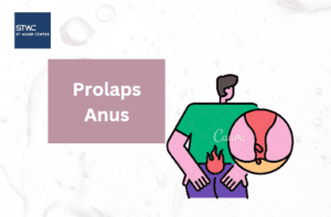 Perbedaan Prolaps Ambeien dan Benjolan Biasa