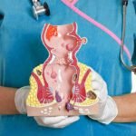 Tindakan Ambeien Tanpa Operasi