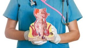 Tindakan Ambeien Tanpa Operasi