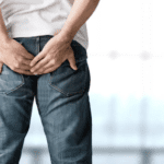 Perbedaan Wasir dan Polip