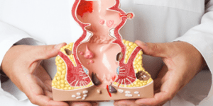 Operasi Fistula Ani, Apakah Menakutkan?