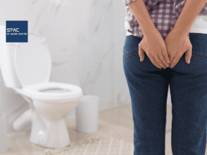 Area Dubur Mudah Lecet