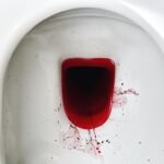 Anus Berdarah Apakah Bahaya