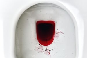 BAB Berdarah Merah Segar