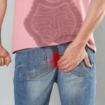 Ambeien Kenapa Terasa Sakit