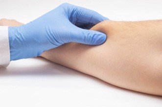Apa yang Harus Dilakukan Jika Jaringan Lipoma Timbul Lagi?