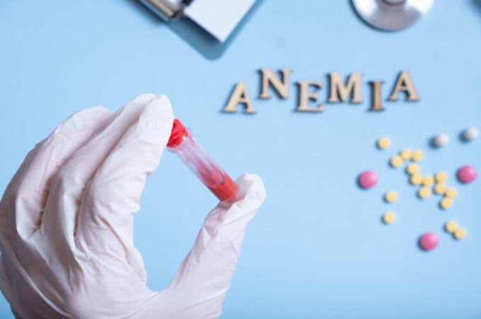 Mengatasi Anemia Akibat Wasir