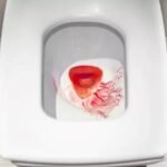 BAB Berdarah Tanpa Sembelit