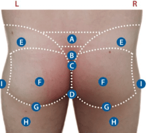 Kulit Dubur Tampak Memerah: Apa Artinya?