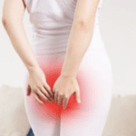 Ambeien Parah Stadium 3