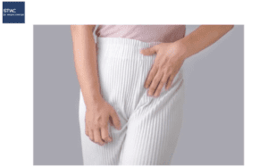 Iritasi pada Kemaluan