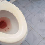 Keluar Darah Segar dari Anus