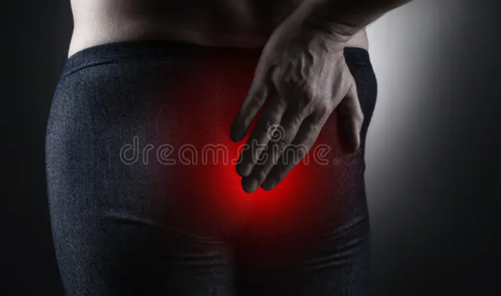 Anus Nyeri Menjalar? Waspadai Masalah Ini!