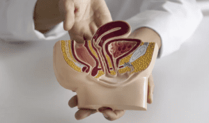 Ambeien Muncul Tanpa Nyeri