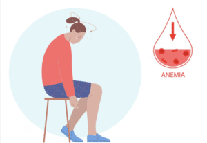 Ambeien Bisa Anemia
