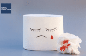 Wasir Mempengaruhi Suasana Hati?