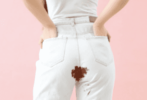 Ambeien Berdarah Saat Menstruasi