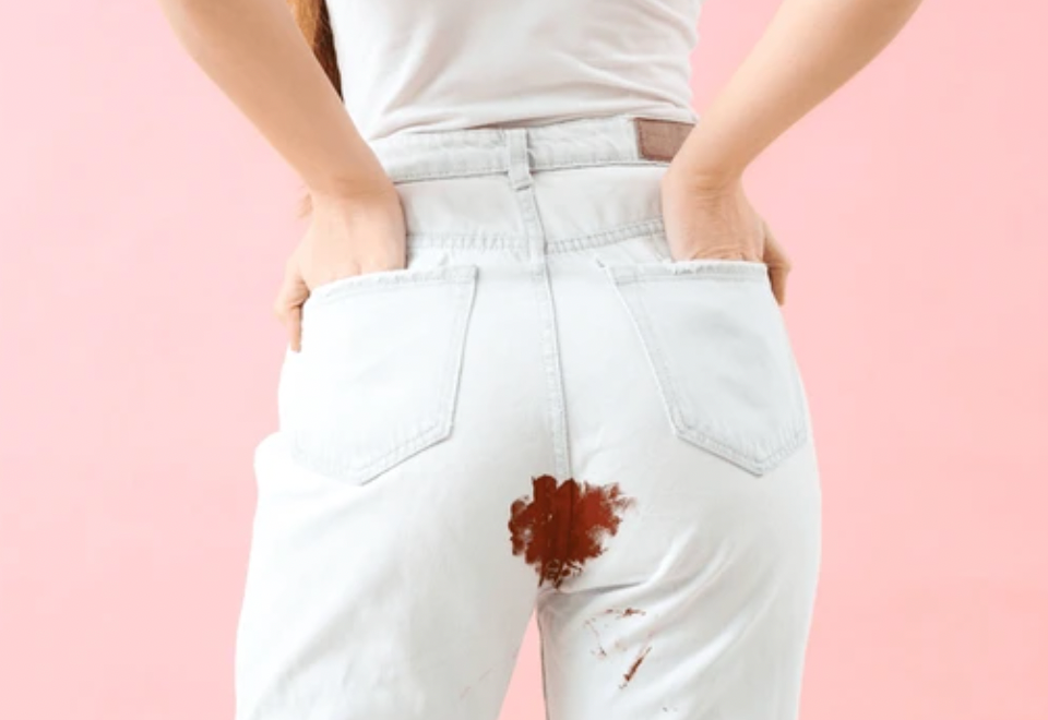 Ambeien Berdarah Saat Menstruasi: Apa Penyebabnya?