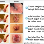 Pemeriksaan Ambeien Terdekat