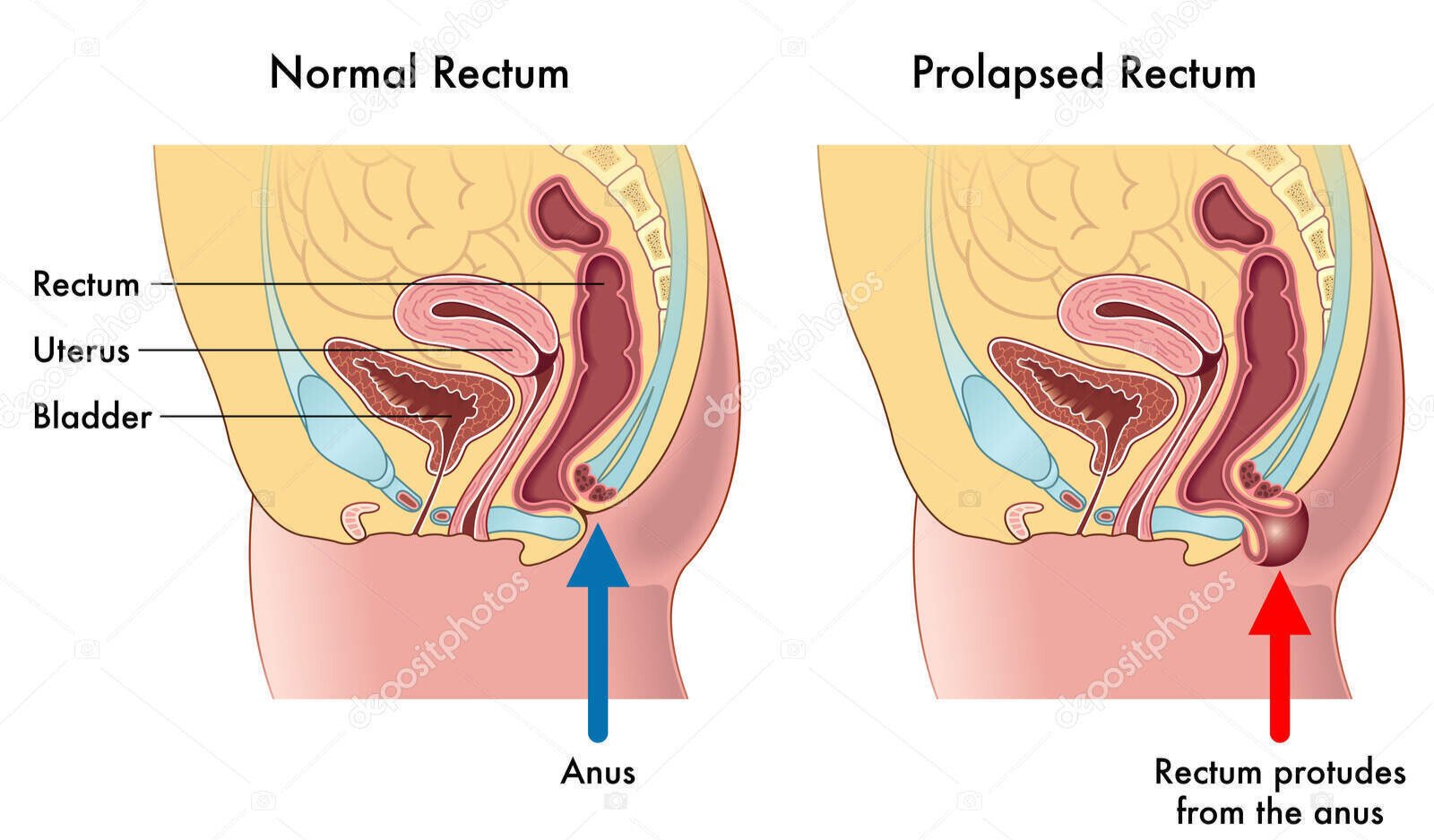 Bentuk Anus yang Sehat